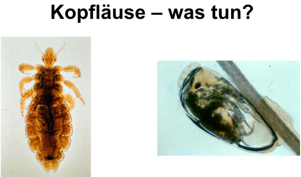 kopflaeuse